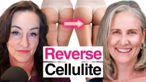 It’s Not Just Aging: Fascia, Lymph, and the Root Cause of Cellulite